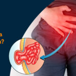 Patient with hernia pain in the abdomen