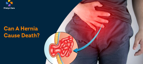Can A Hernia Cause Death?