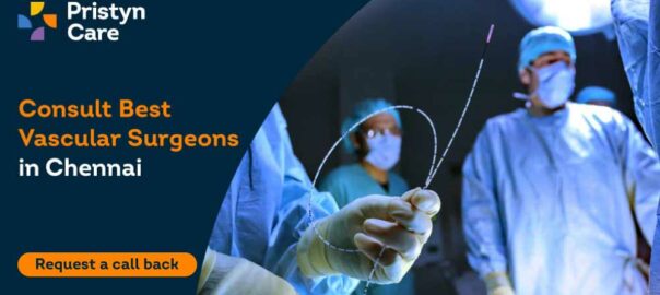 Best Vascular Surgeons in Chennai