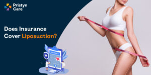 does-insurance-cover-liposuction