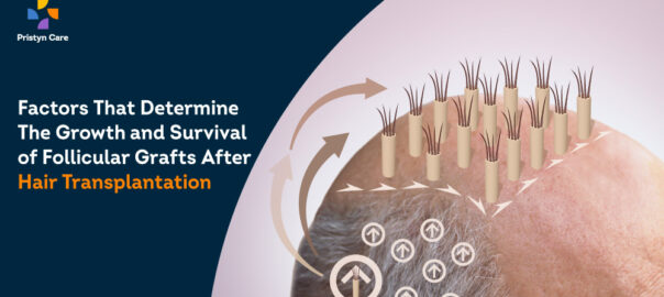 Medically-Proven Factors That Determine The Growth and Survival of Follicular Grafts After Hair Transplantation