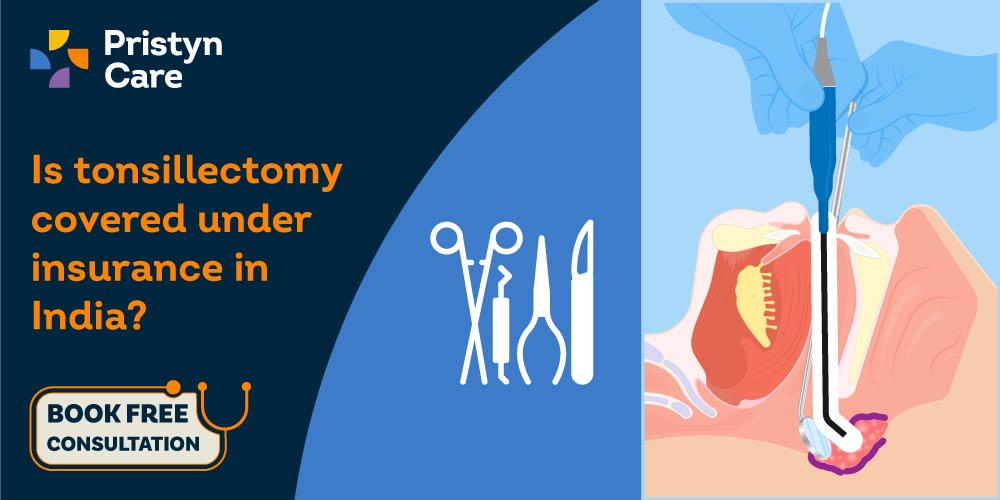 Insurance coverage for tonsillectomy and adenoidectomy surgery