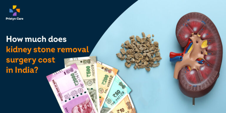 Kidney Stone Removal Surgery Cost in India