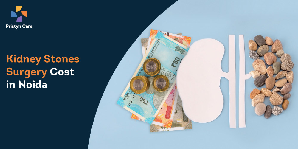 kidney stone surgery cost in noida