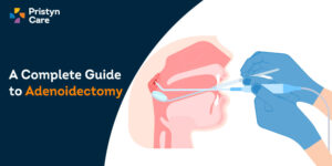A-Complete-Guide-to-Adenoidectomy