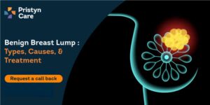 benign breast lump types causes and treatment