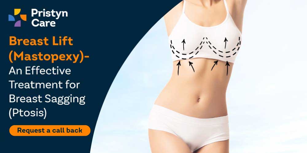 Breast Lift (Mastopexy)- An Effective Treatment for Breast Sagging (Ptosis)  - Pristyn Care