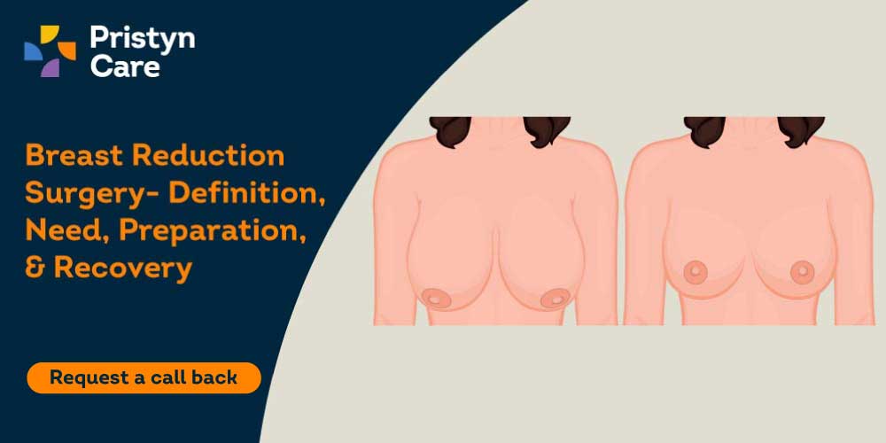 Breast Reduction Surgery- Definition, Need, Preparation, & Recovery -  Pristyn Care