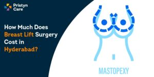 Breast Lift Surgery Cost in Hyderabad