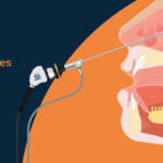 How-Much-Does-FESS-Surgery-Cost