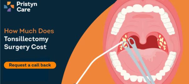 Tonsillectomy Surgery Cost in Kochi