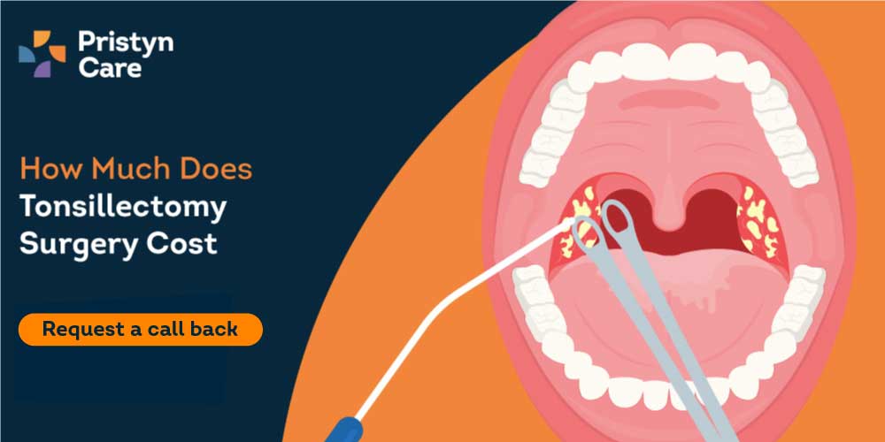 How-Much-Does-Tonsillectomy-Surgery-Cost