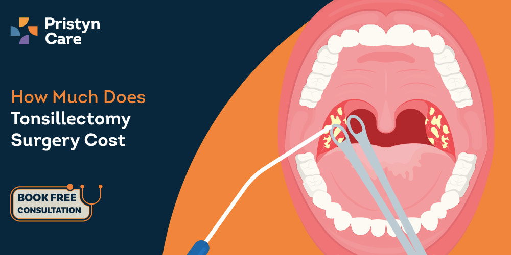 How-Much-Does-Tonsillectomy-Surgery-Cost