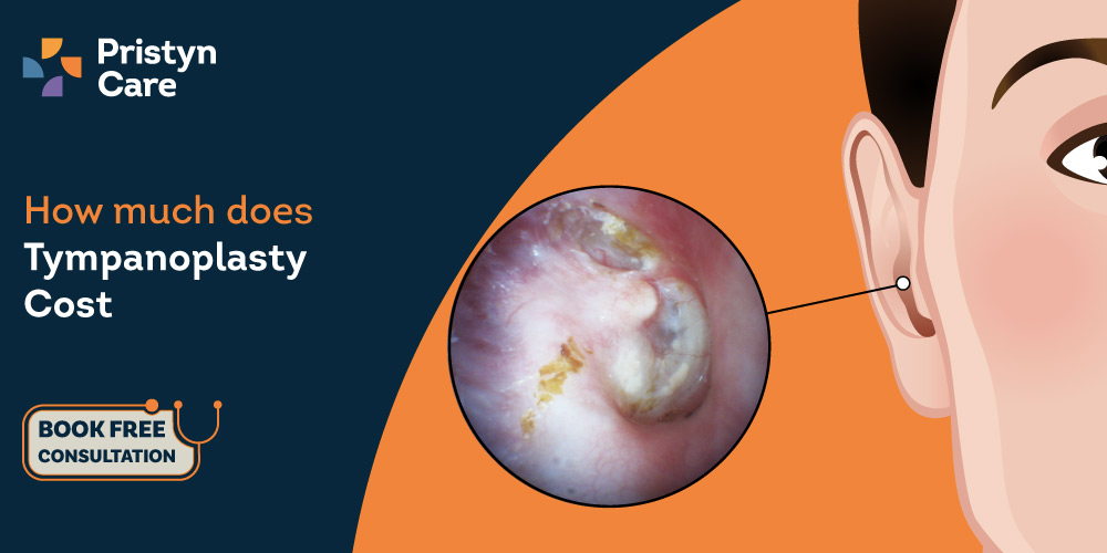 Tympanoplasty Cost