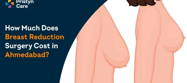 How Much Does Breast Reduction Surgery Cost in Ahmedabad