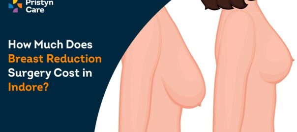 How Much Does Breast Reduction Surgery Cost in Indore