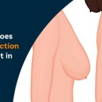 How Much Does Breast Reduction Surgery Cost in Kolkata