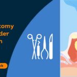 Is-tonsillectomy-covered-under-insurance-in-India