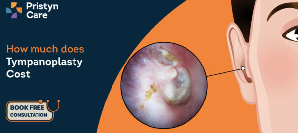 How-much-does-Tympanoplasty-Cost