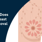 How-Much-Does-Axillary-Breast-Tissue-Removal-Cost-in-Gurgaon