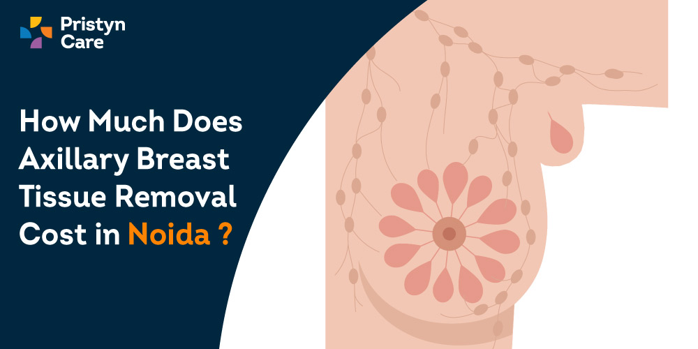 How Much Does Axillary Breast Tissue Removal Cost in Noida?