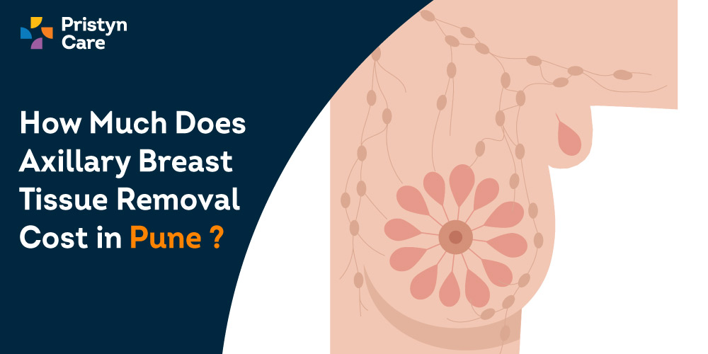 How-Much-Does-Axillary-Breast-Tissue-Removal-Cost-in-Pune