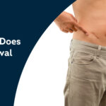 How-Much-Does-Scar-Removal-Cost-in-Gurgaon[1]