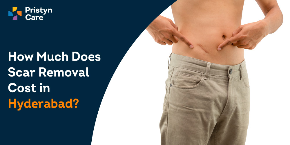 How-Much-Does-Scar-Removal-Cost-in-Hyderabad[1]