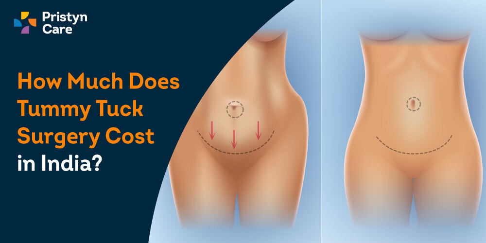 how much does tummy tuck surgery cost in India