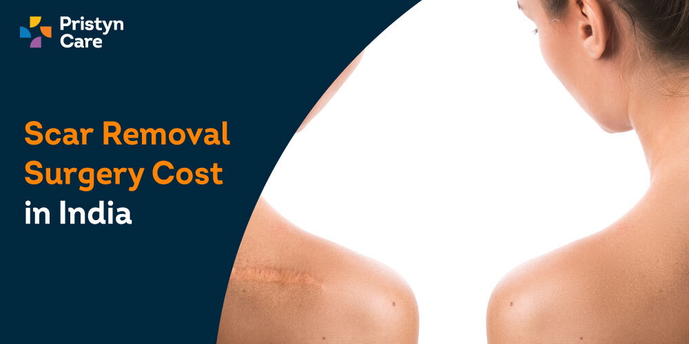 scar removal surgery cost in India