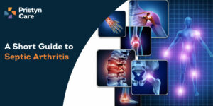 Septic Arthritis- Causes, Symptoms & Diagnosis