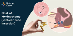 Myringotomy cost in city