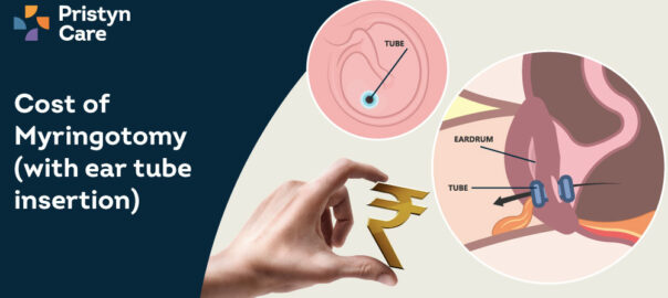 Cost of myringotomy (with ear tubes insertion) in Indore