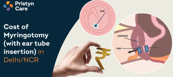 Cost of myringotomy (with ear tubes insertion) in Delhi