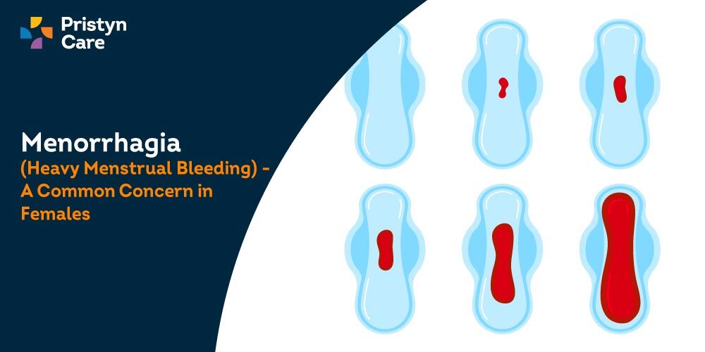 Menorrhagia (Heavy Menstrual Bleeding) - A Common Concern in Females - Pristyn  Care