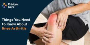 Overview of Knee Arthritis