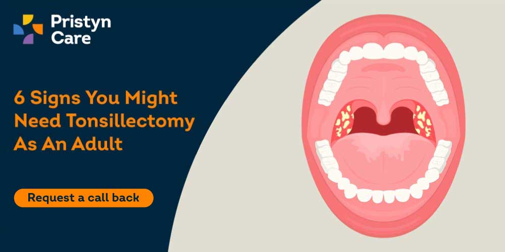 6 Signs You Might Need A Tonsillectomy As An Adult Pristyn Care