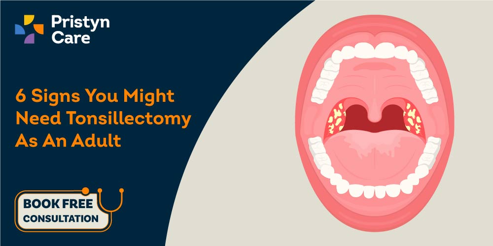 Tonsil surgery for adults