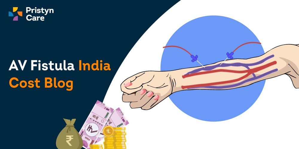 AV Fistula Cost in India