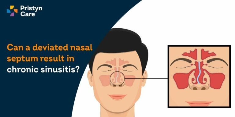 sinusitis from deviated nasal septum