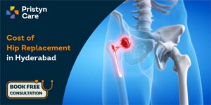 Hip replacement cost in Hyderabad