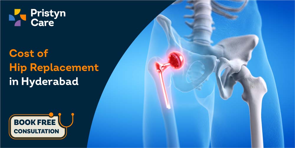 Hip replacement cost in Hyderabad