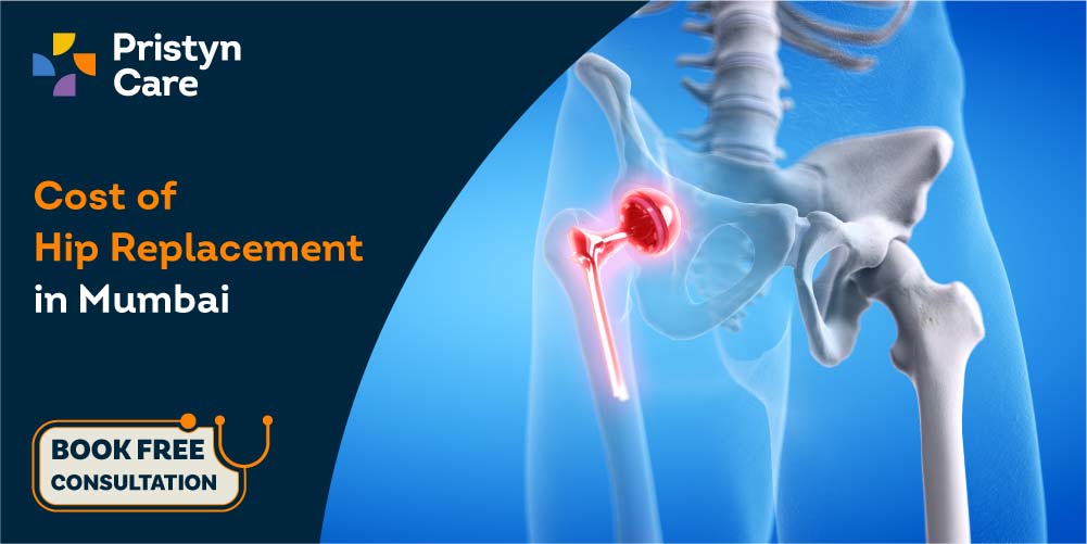 Cost of hip replacement in Mumbai