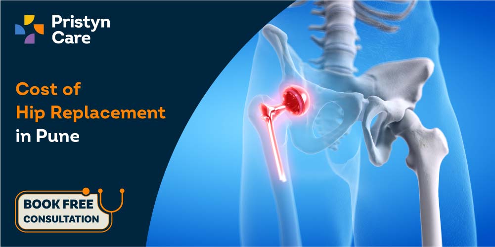 Hip replacement cost in Pune