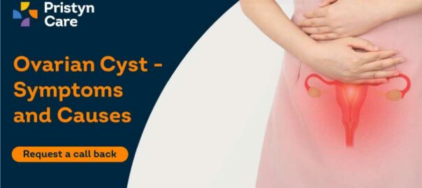 Ovarian Cyst – Symptoms and Causes