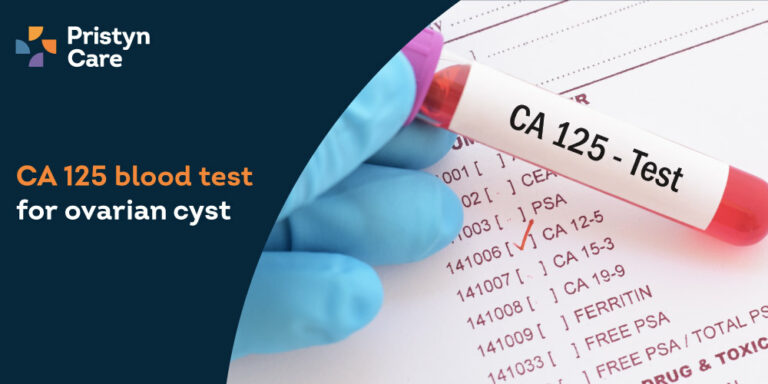 CA 125 Blood test for ovarian cyst