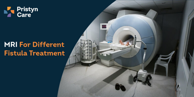 MRI For Different Fistula Treatment