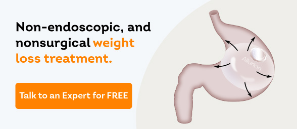 Non Endoscopic and Non Surgical Weight loss treatment