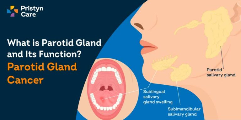 Parotid Gland Cancer