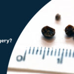 What Size of Kidney Stone Requires Surgery